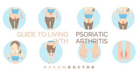 Guide To Living With Psoriatic Arthritis Part 1 Rheumdoctor