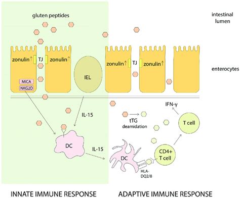 Schematic Representation Of Major Pathways In Celiac Disease Cd