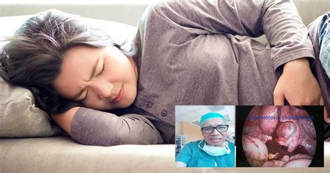 Ivander belum lagi, wanita dengan usia tua yang tidak mampu menghasilkan sel telur yang bagus dapat. 8 Tanda Penyakit Endometriosis Perlu Diawasi Wanita Muda ...