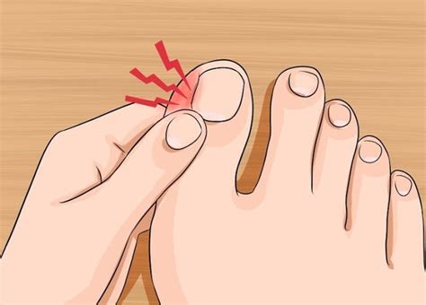 Nyeri pada ibu jari encok biasanya menjadi pemicu sakit yang mendadak muncul pada persendian ibu jari kaki ini. Ketahui Punca Dan 8 Cara Mudah Merawat Cagu Pada Kuku Kaki