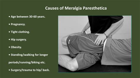 Ppt Meralgia Paresthetica Pain Free Powerpoint Presentation Free