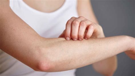 Report Finds Skin Diseases Are More Common Among Americans Than