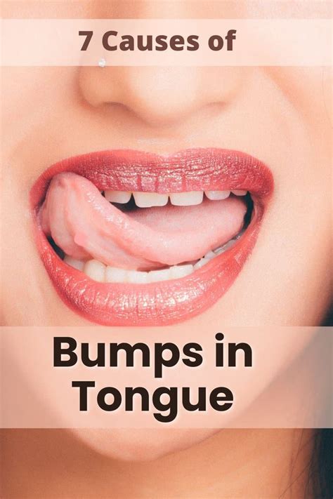 7 Causes Of Bumps In The Back Of Your Tongue Mg