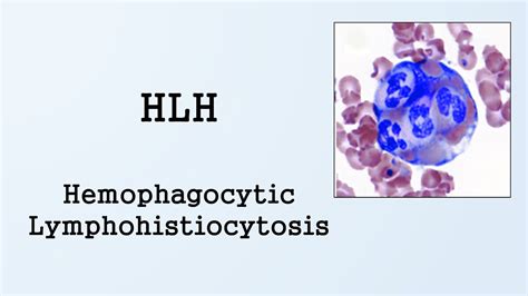 Hemophagocytic Lymphohistiocytosis Hlh Youtube