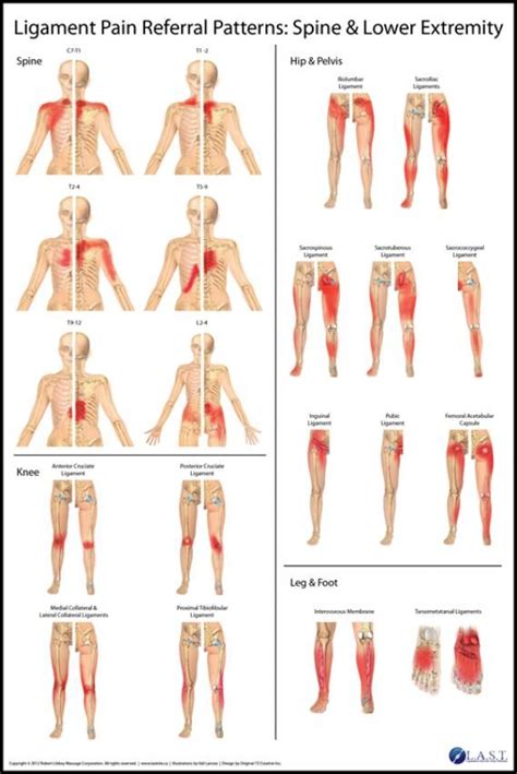 Hip Trigger Points Chart