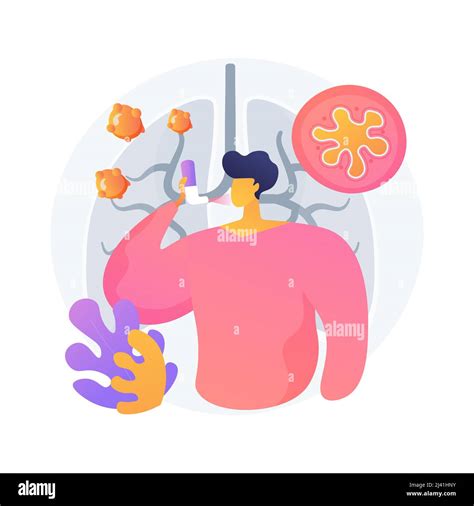 Anaphylaxis Abstract Concept Vector Illustration Severe Allergic