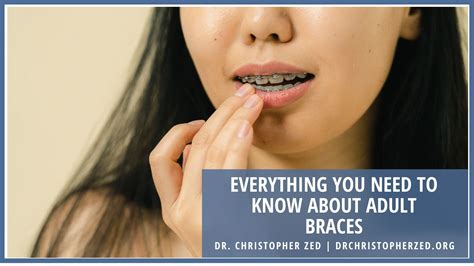 Everything You Need To Know About Adult Braces Dr Christopher Zed Healthcare