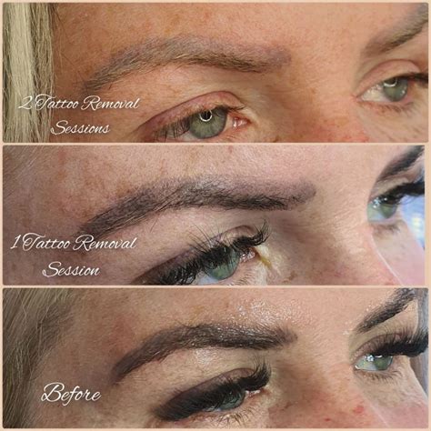 Pink And Blue Eyebrows After Microblading Eyebrow Tattoo Elite Look