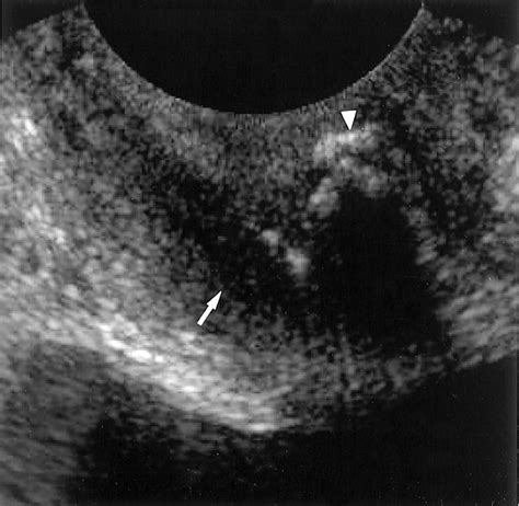 Cross Sectional Imaging Of The Female Urethra Technique And Results