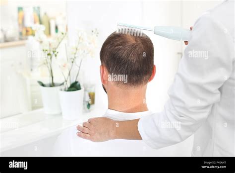 Treatment Against Hair Loss Microneedle Mesotherapy Of The Scalp The