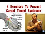 Photos of Carpal Tunnel Exercises