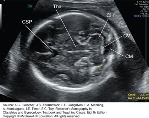 Fetal Biometry Obgyn Key