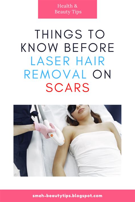 Laser Hair Removal On Scars Explained