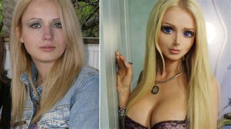 Most Ridiculous Plastic Surgeries People Have Gotten To Look Like Someone Else Gallery