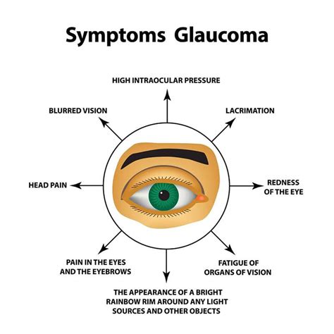 Glaucoma Symptoms Photos