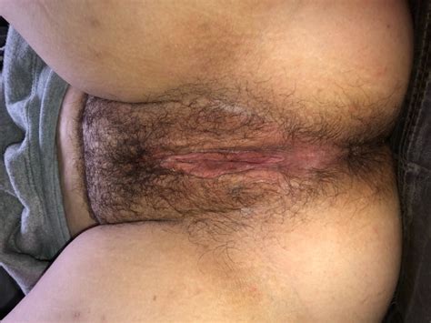 More Of My Pussy And Asshole Hairy And Shaved 63 Pics Xhamster