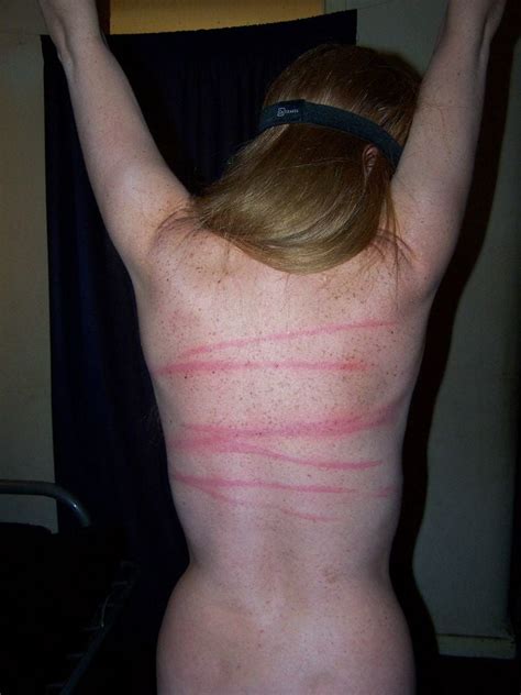 Whipped Backs Of Girls Pics Xhamster