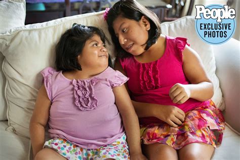 Josie Hull And Teresa Cajas Formerly Conjoined Twins 21 Years Later