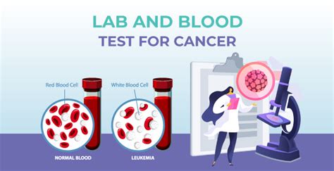 Learn About 5 Common Lab Tests For Cancer Diagnosis Mrmed