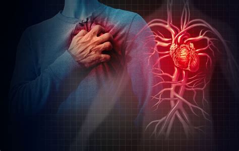 Quale Differenza Cè Tra Un Infarto Un Arresto Cardiaco E Un Ictus