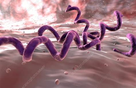 Syphilis Stock Image C0082354 Science Photo Library