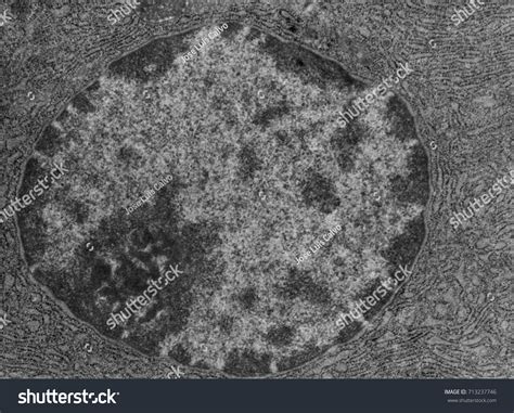 Nucleolus Electron Micrograph