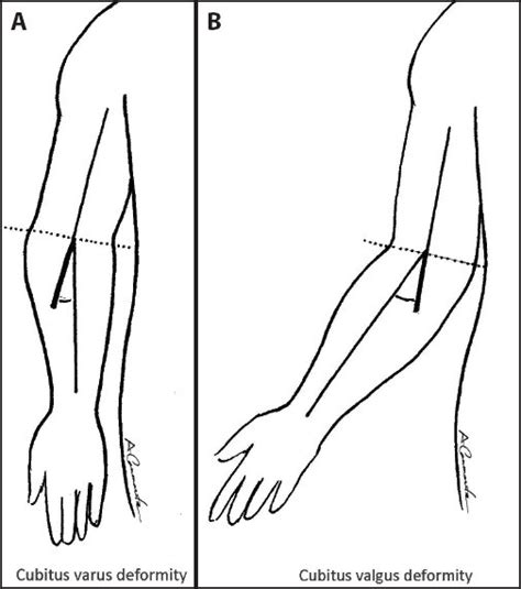 Anatomical And Biomechanical Principles Of Orthotic Intervention