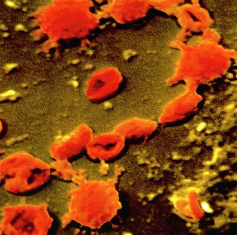 False Colour Sem Of Mycoplasma Pneumoniae Photograph By Cnriscience
