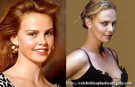 Nothing Found For Charlize Theron Plastic Surgery Plastic Surgery