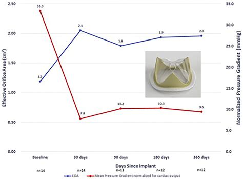 Foldax Tria Surgical Valve Early Feasibility Study In Humans—eoa And