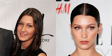Bella Hadid Plastic Surgery Before And After Photos Celeblenscom