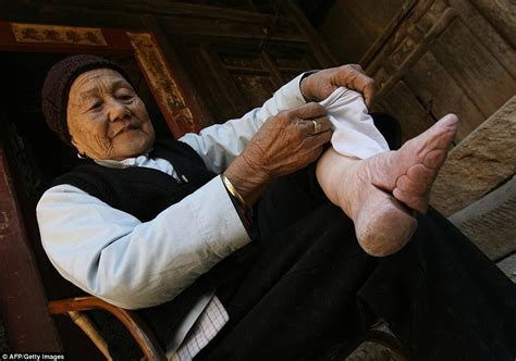 Shocking Pictures Of Chinas Bound Feet Women Village Daily Mail Online