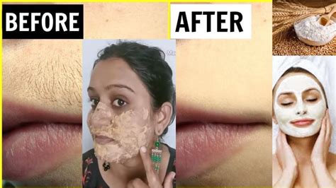 how to remove facial hair permanently 100 natural home remedy गवहाच्या पिठाने काढा facial