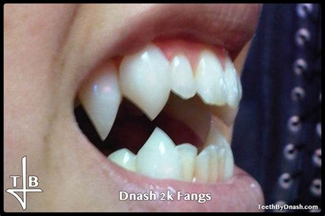 Dnash Teeth By Dnash