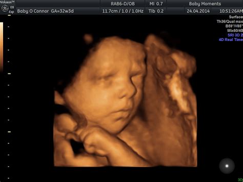 2d3d4d Wellbeing Package Baby Moments 3d 4d Ultrasound Scan Centre