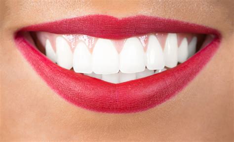 Beautiful Smile With Teeth Stock Photo Download Image Now Istock