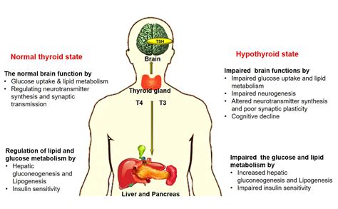 Ijms Free Full Text Hypothyroidism And Diabetes Related Dementia
