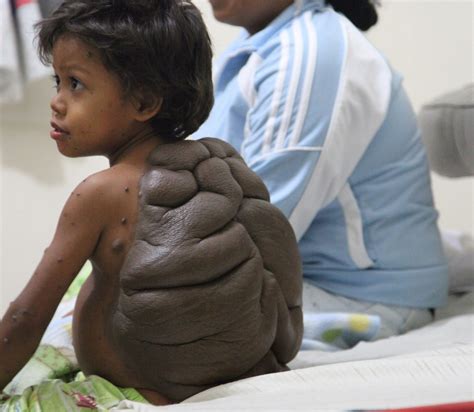 Turtle Boy – TBI Vision