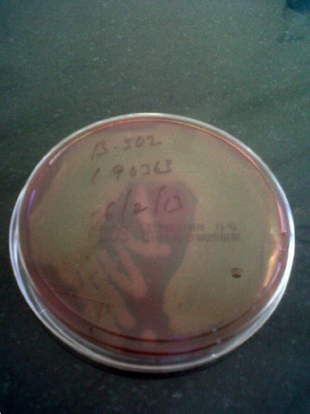 Non Lactose Fermenting Colonies On Macconkey Agar Download