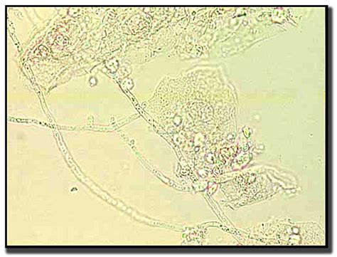 Common Infectious Diseases Wisconsin State Laboratory Of Hygiene