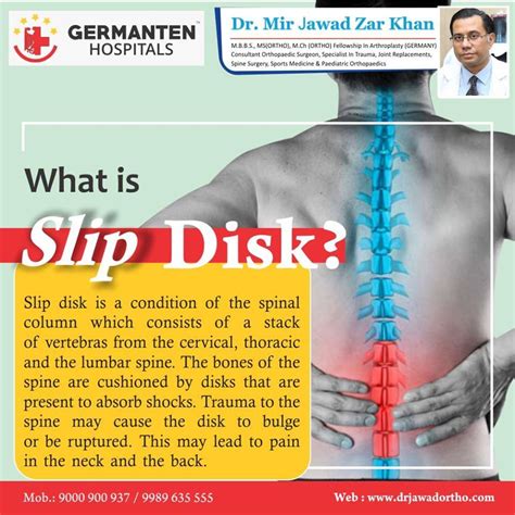 Department Of Spine And Neurology Spine Surgery Celiac Plexus Spinal