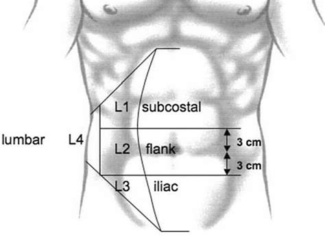 Schematic Of Lateral Hernia Classification Cited From European Hernia
