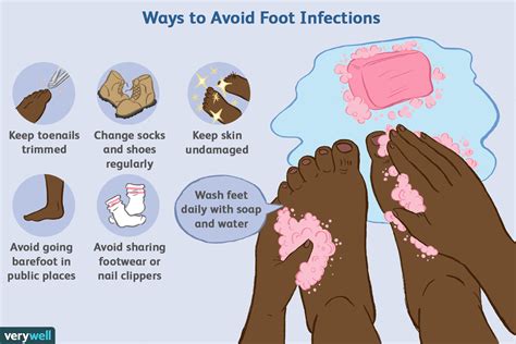 Häufige Infektionen Des Fußes Medde