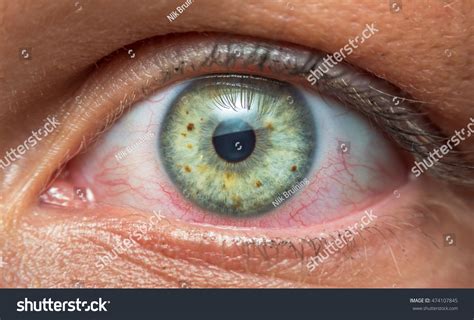 Human Eye Blood Vessels Stock Photo 474107845 Shutterstock
