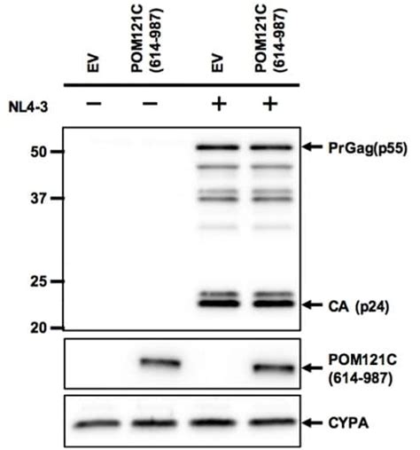 Western Blot Test For Hiv