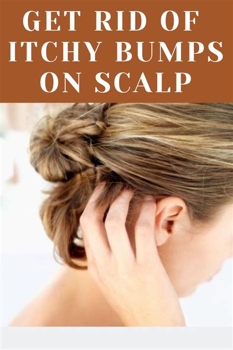 What Causes Itchy Bumps On Scalp And How You Can Get Rid Of Them In