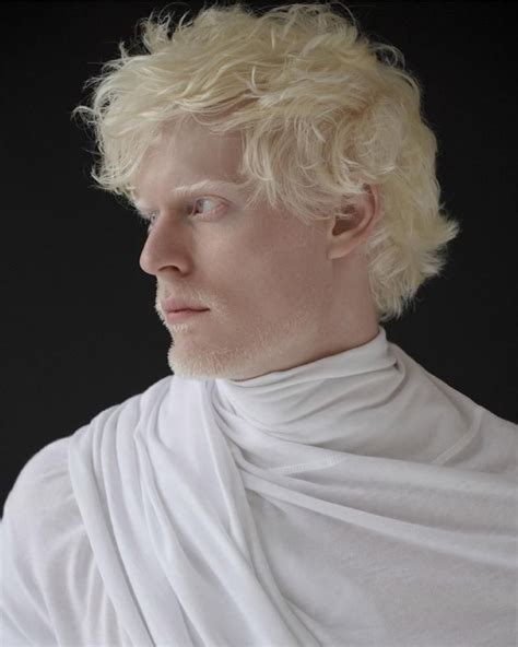 Stephen Thompson Albino Human Modelo Albino Albino Model Beautiful