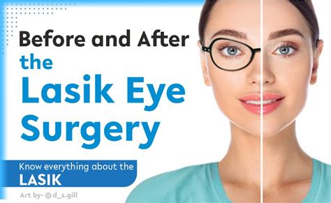Before And After Lasik Eye Surgery Know Everything About The LASIK