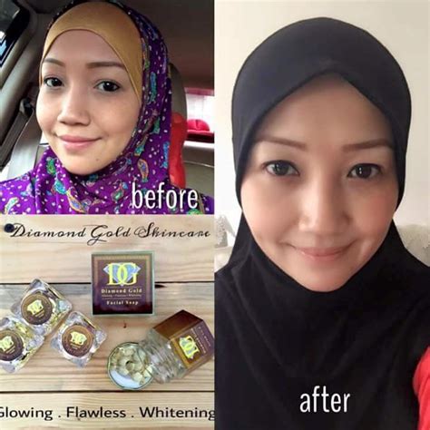 Want to give your skin the treatment that it deserves? Ruang Coretan Cik Ila Kidal: Diamond Gold Skincare