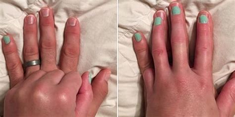 This Husband Painted His Pinky To Support His Wife Who